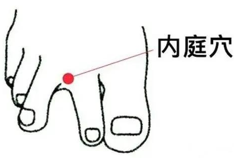 内庭穴位于脚背第2,3脚趾结合部前方凹陷处,每天早晚按压内庭穴各